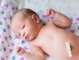 Кровит пупок у новорожденного: что делать? Как лечить?