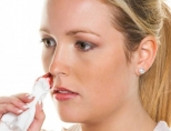 Кровь из носа: причины, что делать? Как остановить?