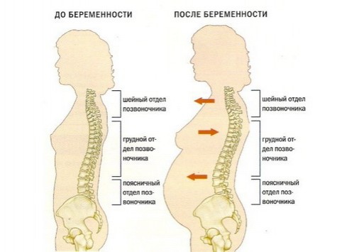 Почему появляются боли в спине у беременных?