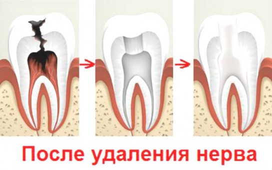 Причины зубной боли