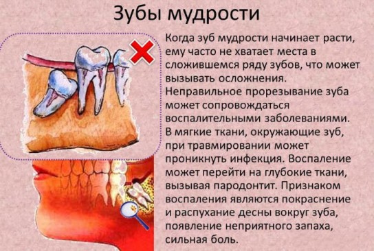 Фото как набухают десна при прорезывании