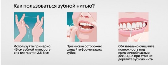 Разновидности зубных нитей