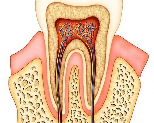 Удален нерв, стоит коронка, а зуб болит – что делать?