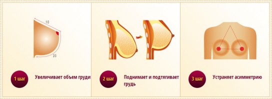 Три способа увеличить грудь без скальпеля