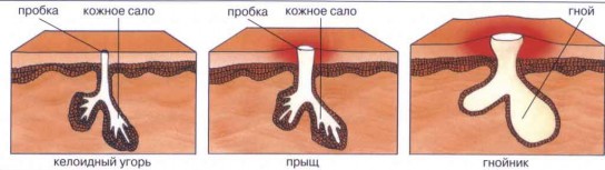 Современные косметологические процедуры