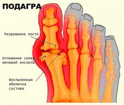 Лечение патологии